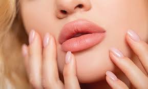 Lip Filler