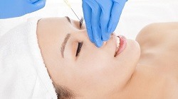 Non-surgical Nose Reduction