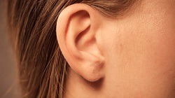 Non-surgical Ear Aesthetic