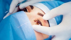 Non-surgical Eye Aesthetic